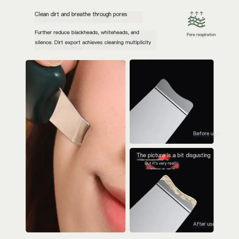 Mini Manual Pore Cleaning Device for Home Use